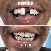 Orthodontic Care
